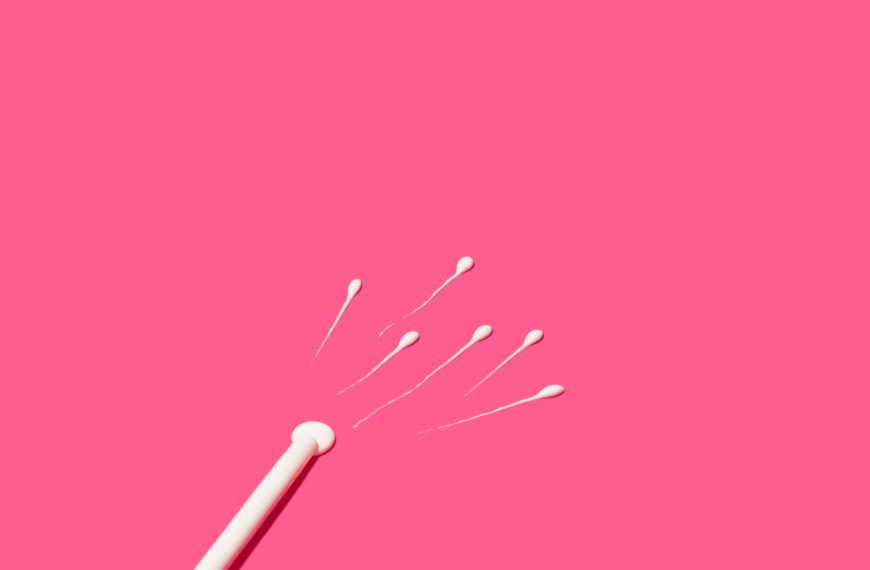 Espermatozoides siendo introducidos en el útero durante un tratamiento de inseminación artificial (IA).