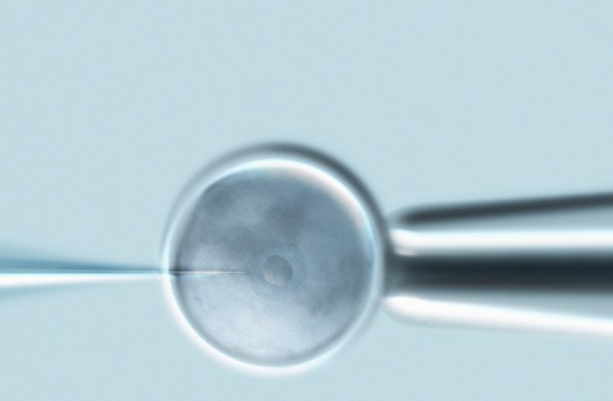 Microinyección intracitoplasmática de espermatozoides (ICSI) en un óvulo, parte de un tratamiento de fertilización in vitro.