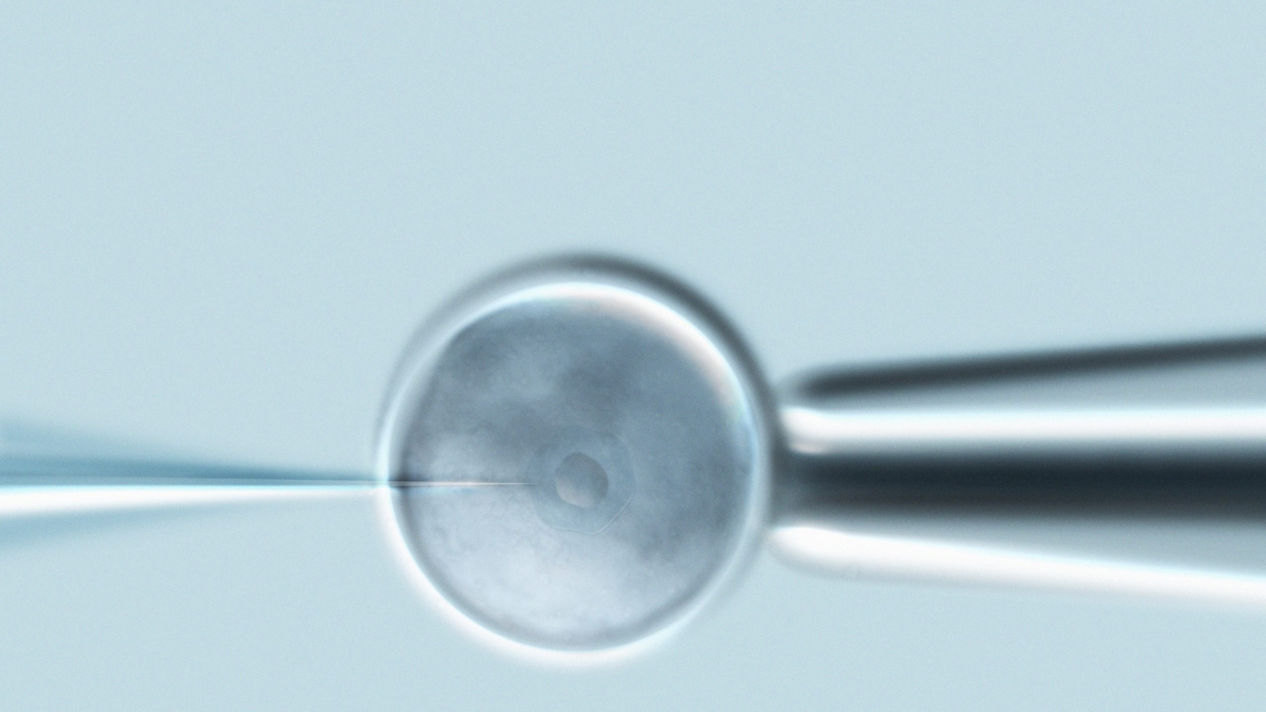 Microinyección intracitoplasmática de espermatozoides (ICSI) en un óvulo, parte de un tratamiento de fertilización in vitro.